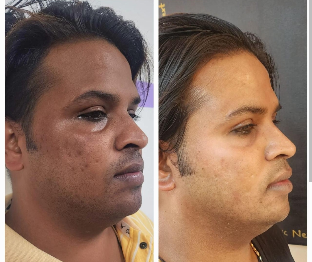 Hair Treatment Result 3