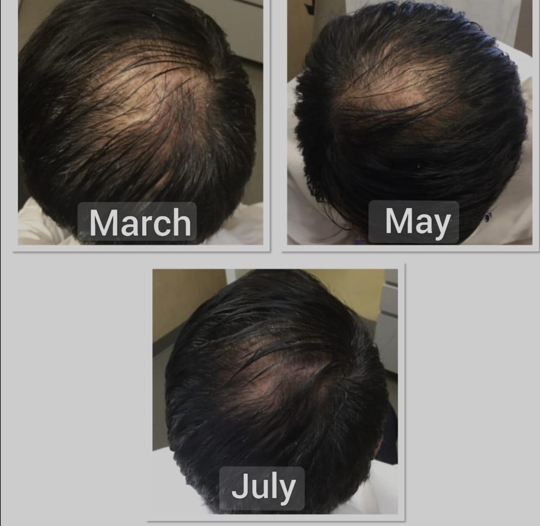 Hair Treatment Result 4